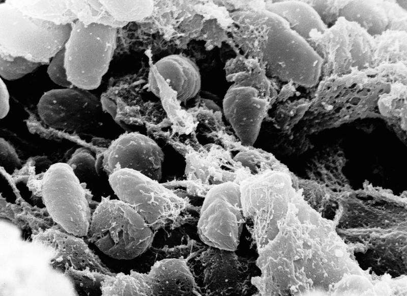 Colorado reports human case of bubonic plague in Montezuma County The