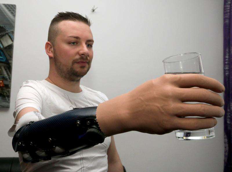 Groundbreaking achievement as bionic hand mer